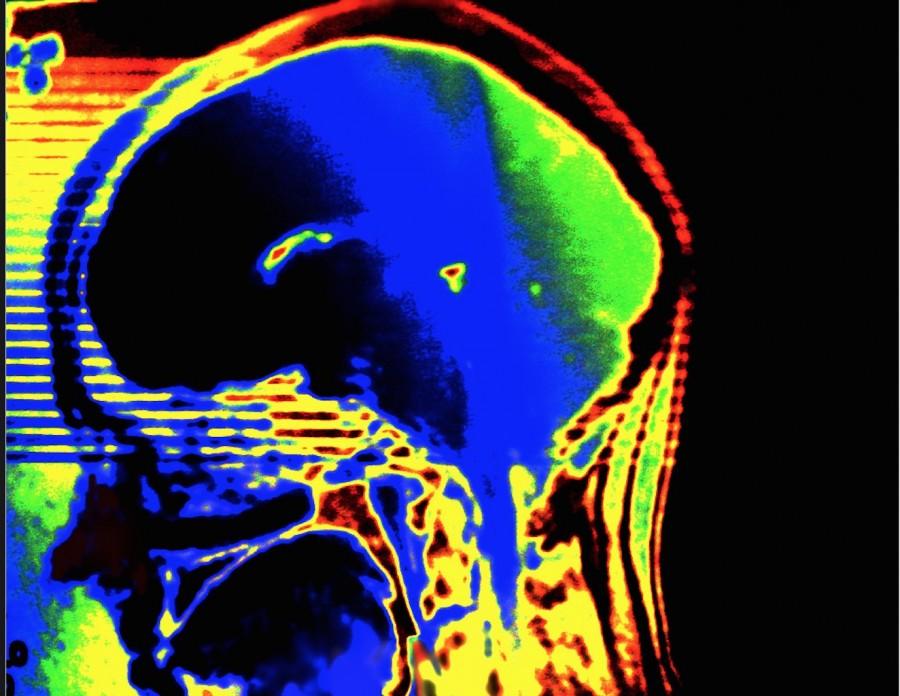 Ongoing brain research shows a connection between new learning and brain health:  Even if we cannot compare three months of intensive language study with a lifetime… there is a lot to suggest that learning languages is a good way to keep the brain in shape,” lead researcher Johan Mårtensson said.