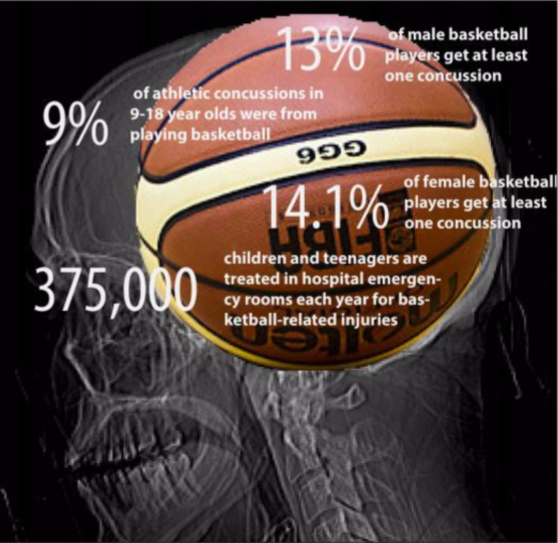 Infographic information from NCAA, the pediatric journal: "Emergency Department Visits for Concussion in Young Child Athletes."