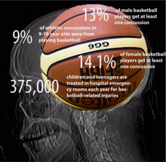 Infographic information from NCAA, the pediatric journal: Emergency Department Visits for Concussion in Young Child Athletes.