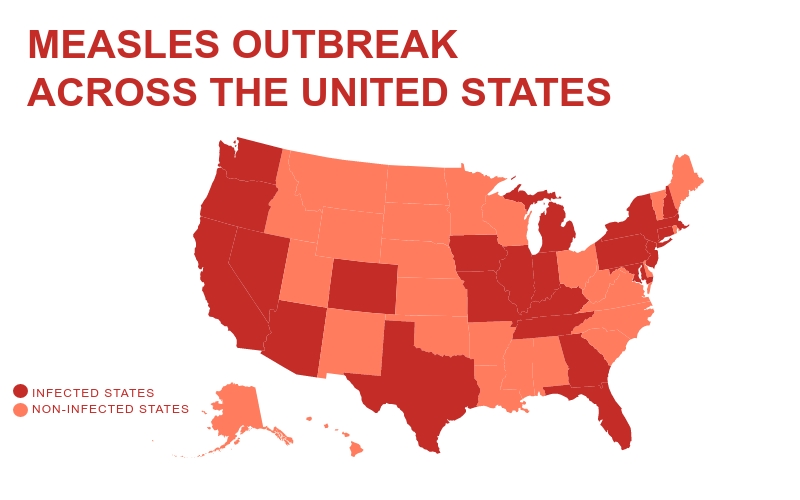 The Measles symptoms can look common, but have deadly consequences in young children. Over the past four years, the Measles outbreak has increased rapidly, reappearing in 23 states to date.